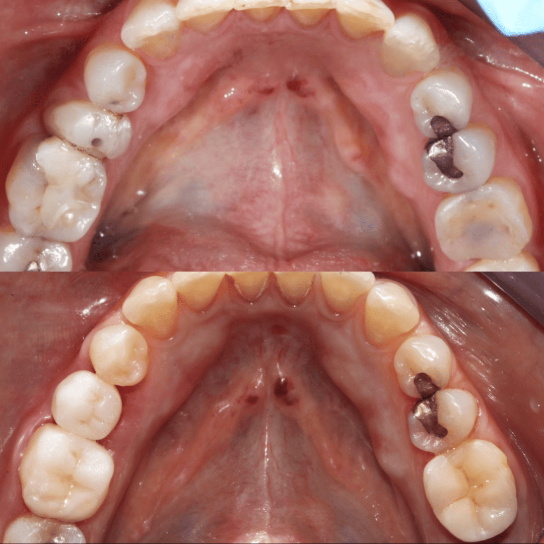 Rehabilitación oral